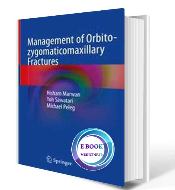 دانلود کتاب Management of Orbito-zygomaticomaxillary Fractures 1st ed. 2020 ( PDF)